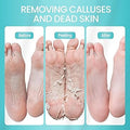 Exfoliating Foot Peel Mask - Removes Dead Skin & Calluses